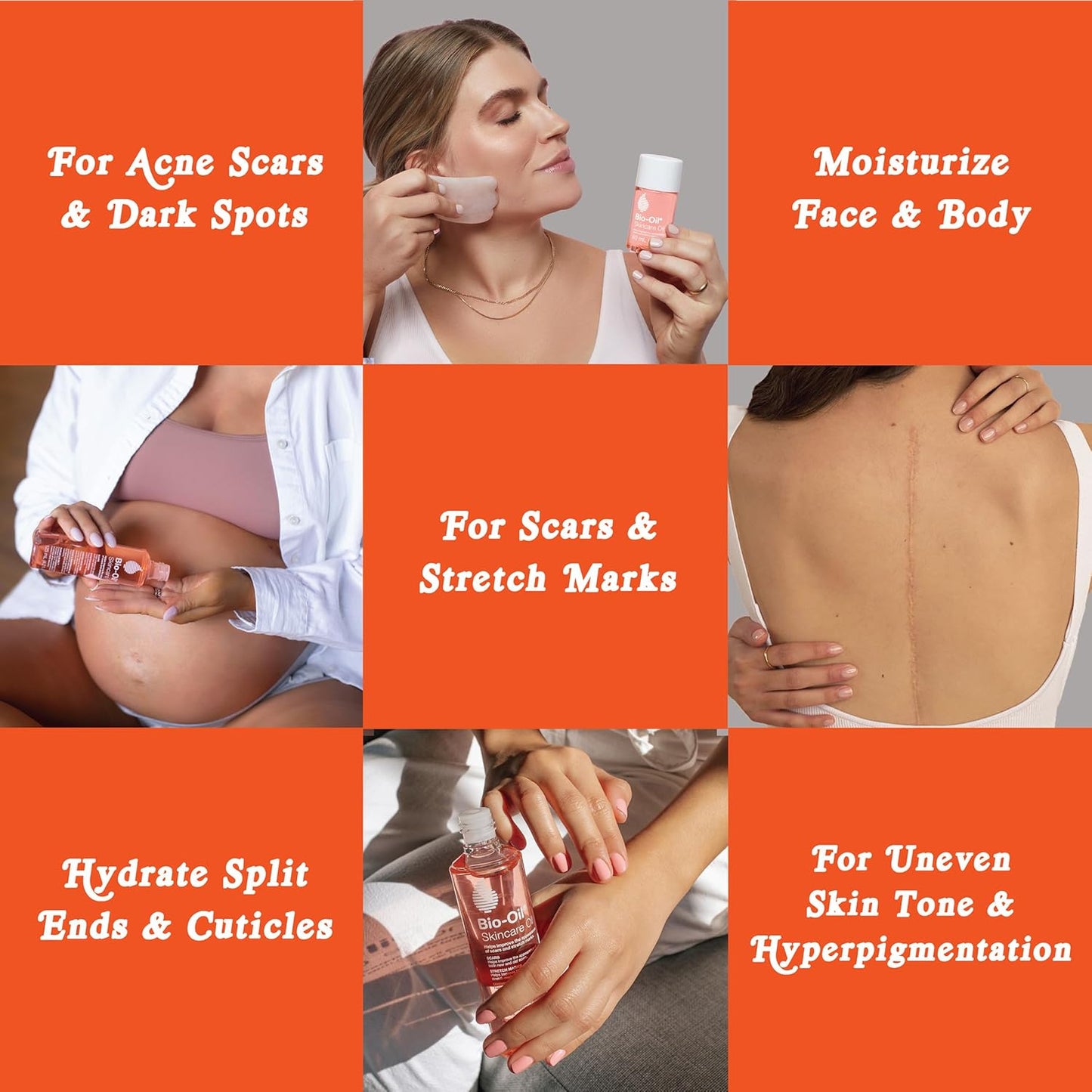Bio-Oil Skincare Body Oil, Vitamin E, Serum for Scars & Stretchmarks, Face & Body Moisturizer, 2 oz, All Skin Types