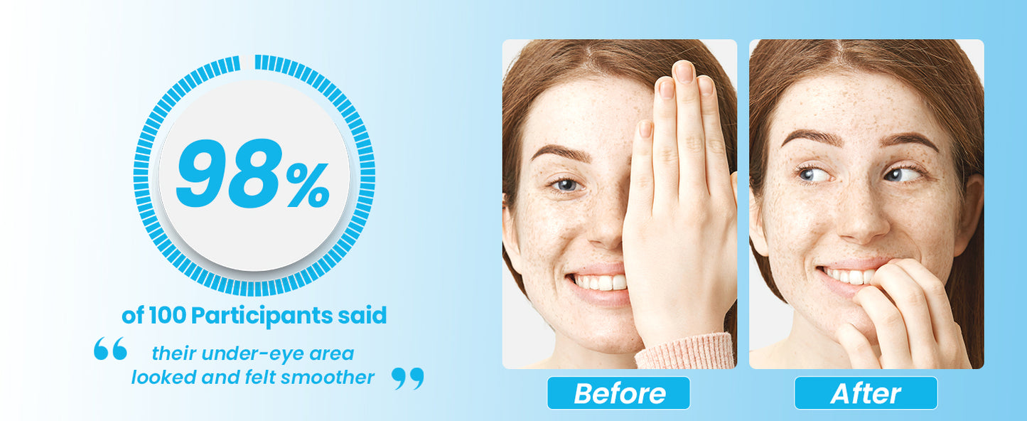 Patchology Iced Cooling Under Eye Mask Patches with Peptides, Cloudberry Oil and Bakuchiol. Cool eye gels to firm skin and soothe, reduce fine lines and under eye bags 5 Pair